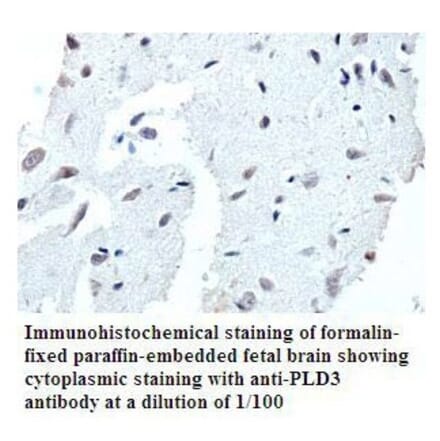 PLD3 Antibody from Signalway Antibody (39791) - Antibodies.com