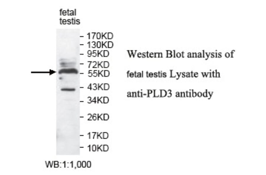 PLD3 Antibody from Signalway Antibody (39791) - Antibodies.com