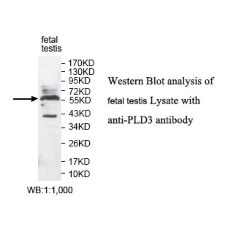 PLD3 Antibody from Signalway Antibody (39791) - Antibodies.com