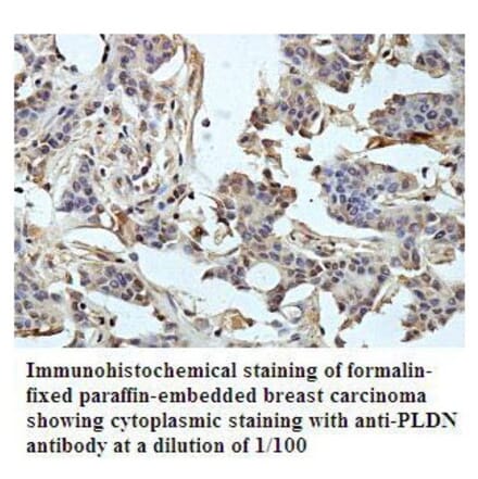 PLDN Antibody from Signalway Antibody (39792) - Antibodies.com