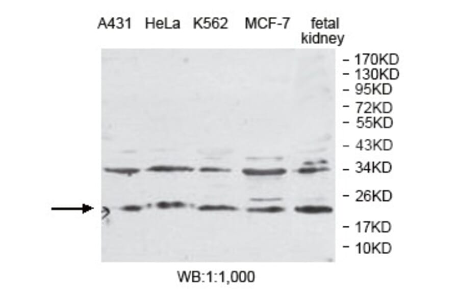 PLDN Antibody from Signalway Antibody (39792) - Antibodies.com