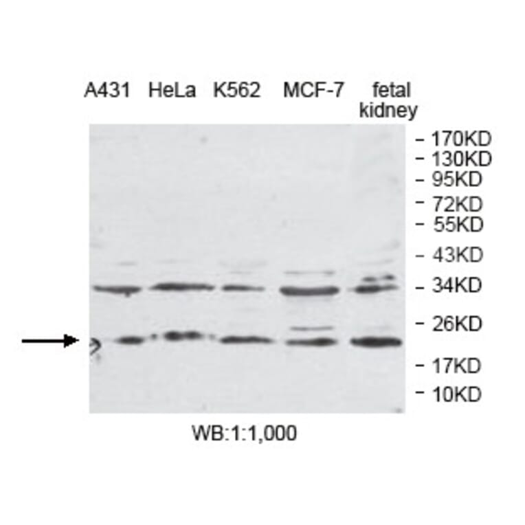 PLDN Antibody from Signalway Antibody (39792) - Antibodies.com