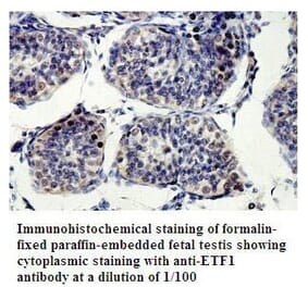 ETF1 Antibody from Signalway Antibody (39802) - Antibodies.com