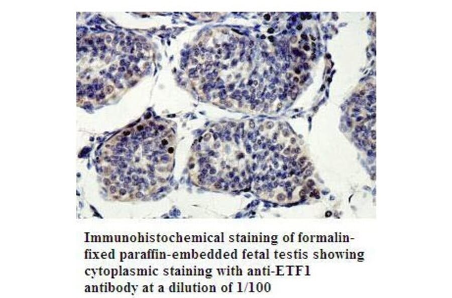 ETF1 Antibody from Signalway Antibody (39802) - Antibodies.com