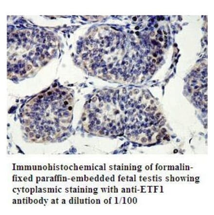 ETF1 Antibody from Signalway Antibody (39802) - Antibodies.com