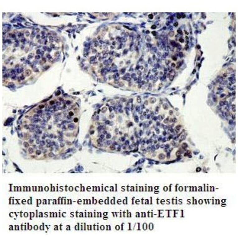 ETF1 Antibody from Signalway Antibody (39802) - Antibodies.com