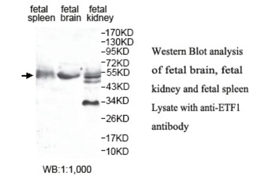 ETF1 Antibody from Signalway Antibody (39802) - Antibodies.com