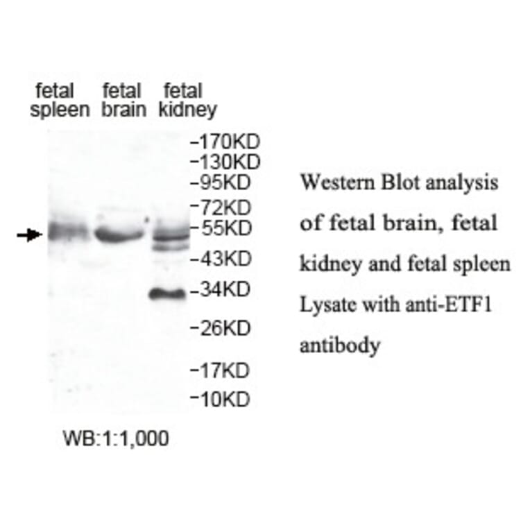 ETF1 Antibody from Signalway Antibody (39802) - Antibodies.com