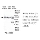 ETF1 Antibody from Signalway Antibody (39802) - Antibodies.com