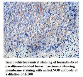 ANO9 Antibody from Signalway Antibody (39822) - Antibodies.com