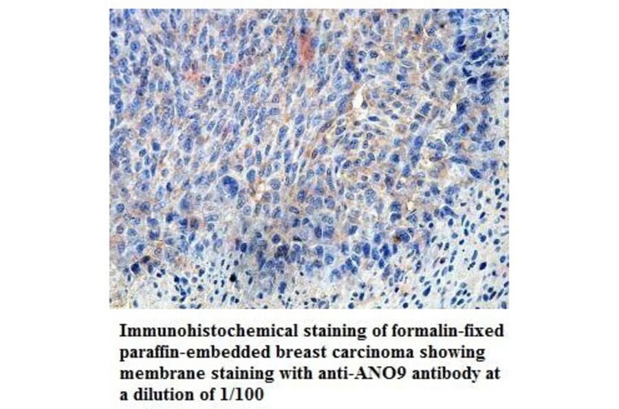 ANO9 Antibody from Signalway Antibody (39822) - Antibodies.com
