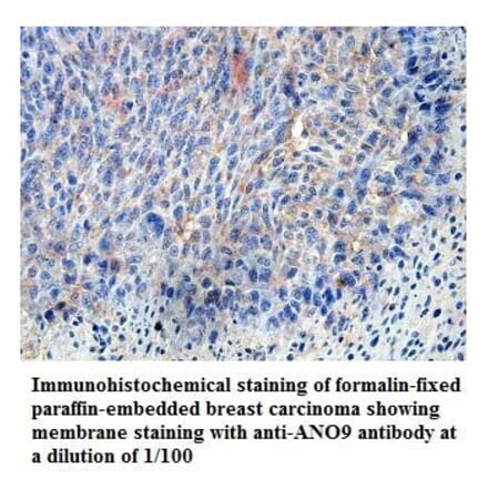 ANO9 Antibody from Signalway Antibody (39822) - Antibodies.com