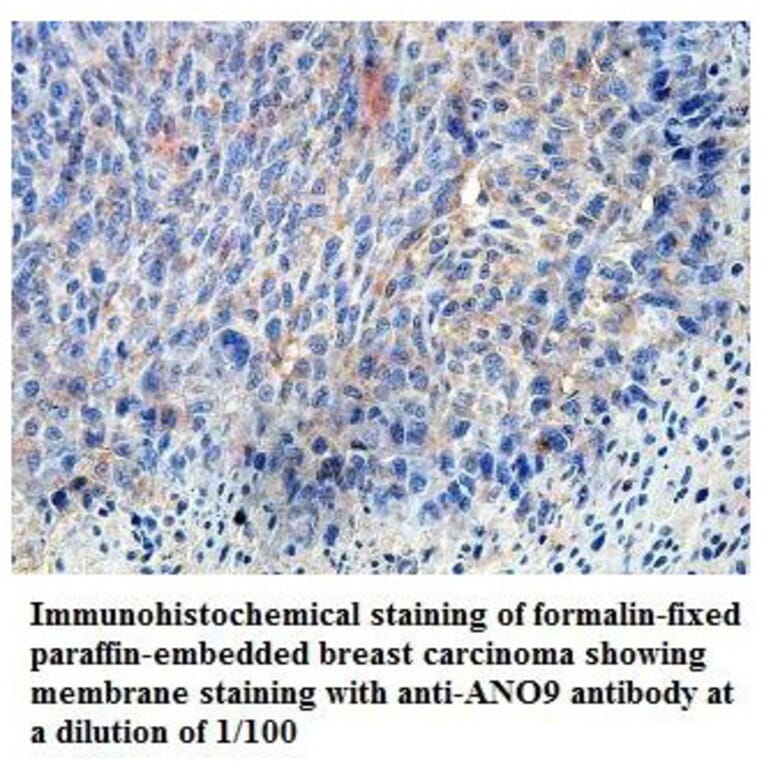 ANO9 Antibody from Signalway Antibody (39822) - Antibodies.com