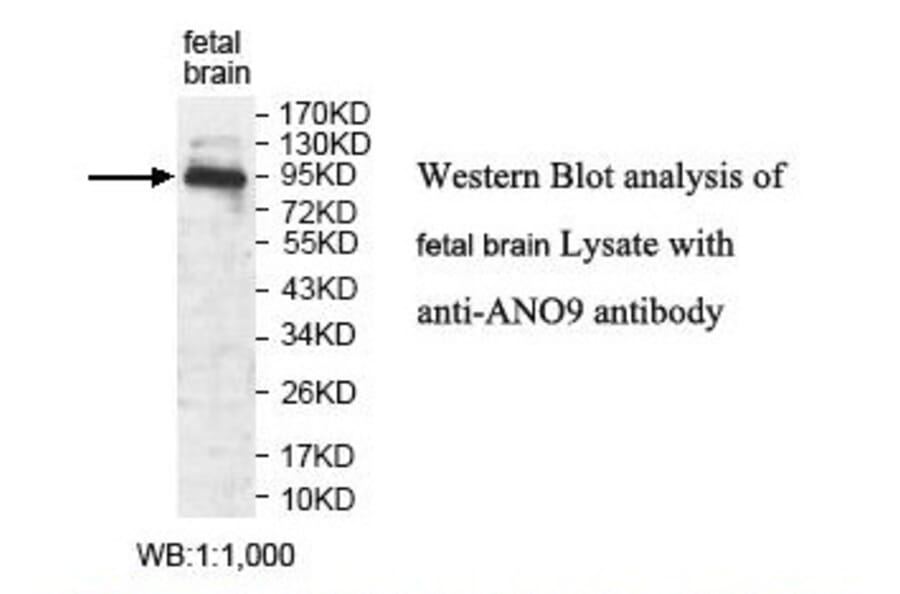 ANO9 Antibody from Signalway Antibody (39822) - Antibodies.com