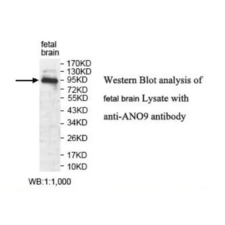 ANO9 Antibody from Signalway Antibody (39822) - Antibodies.com