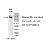 ANO9 Antibody from Signalway Antibody (39822) - Antibodies.com