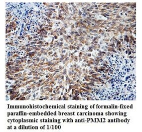 PMM2 Antibody from Signalway Antibody (39827) - Antibodies.com