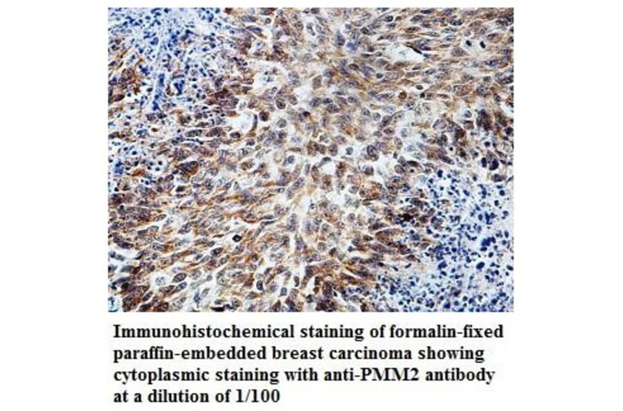 PMM2 Antibody from Signalway Antibody (39827) - Antibodies.com