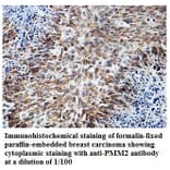 PMM2 Antibody from Signalway Antibody (39827) - Antibodies.com