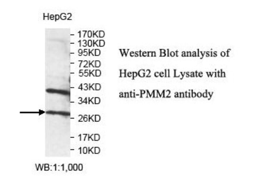 PMM2 Antibody from Signalway Antibody (39827) - Antibodies.com