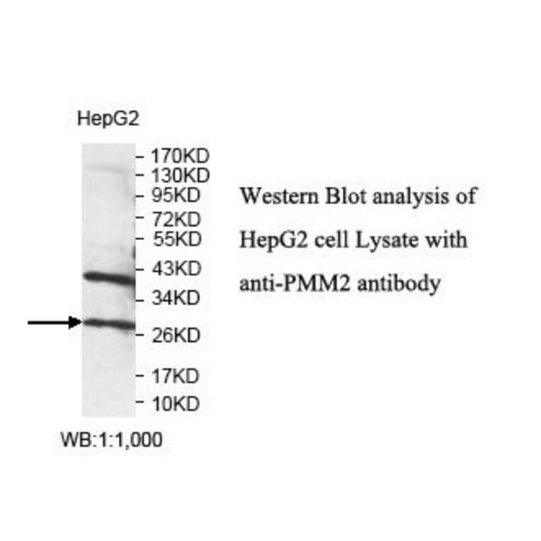 PMM2 Antibody from Signalway Antibody (39827) - Antibodies.com