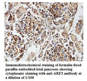 ARF3 Antibody from Signalway Antibody (39829) - Antibodies.com