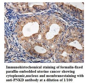 PNKD Antibody from Signalway Antibody (39834) - Antibodies.com