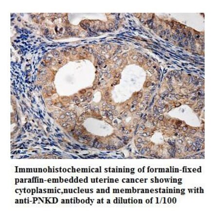 PNKD Antibody from Signalway Antibody (39834) - Antibodies.com