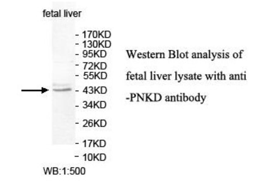 PNKD Antibody from Signalway Antibody (39834) - Antibodies.com