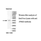 PNKD Antibody from Signalway Antibody (39834) - Antibodies.com