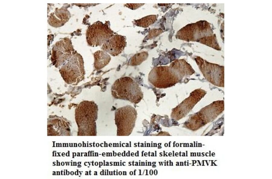 PMVK Antibody from Signalway Antibody (39840) - Antibodies.com