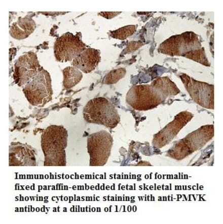 PMVK Antibody from Signalway Antibody (39840) - Antibodies.com