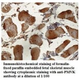 PMVK Antibody from Signalway Antibody (39840) - Antibodies.com