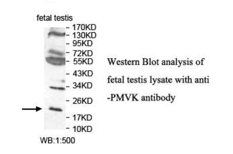 PMVK Antibody from Signalway Antibody (39840) - Antibodies.com