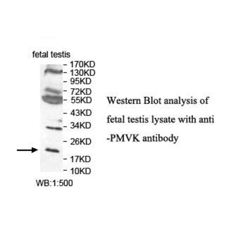 PMVK Antibody from Signalway Antibody (39840) - Antibodies.com