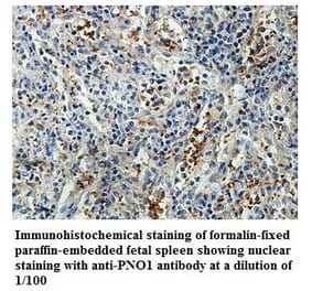 PNO1 Antibody from Signalway Antibody (39851) - Antibodies.com
