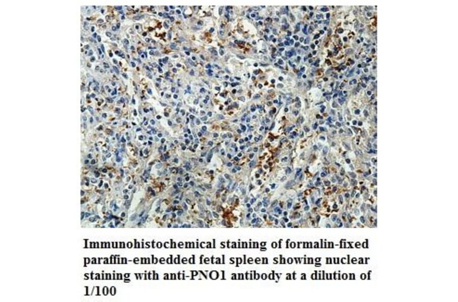 PNO1 Antibody from Signalway Antibody (39851) - Antibodies.com