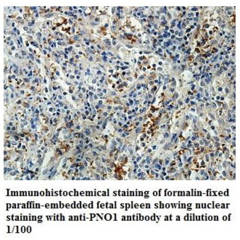 PNO1 Antibody from Signalway Antibody (39851) - Antibodies.com