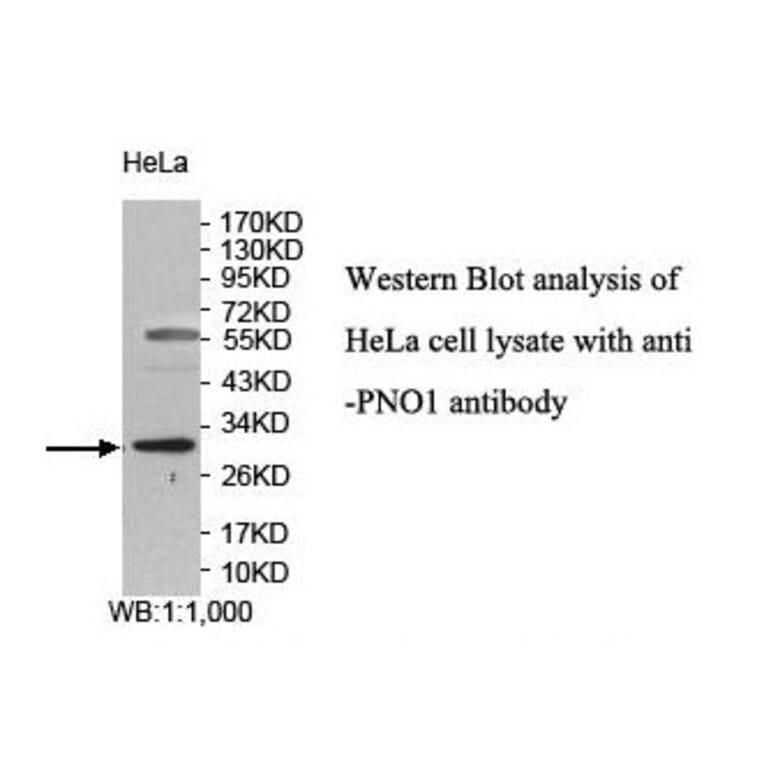 PNO1 Antibody from Signalway Antibody (39851) - Antibodies.com