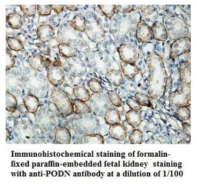 PODN Antibody from Signalway Antibody (39852) - Antibodies.com