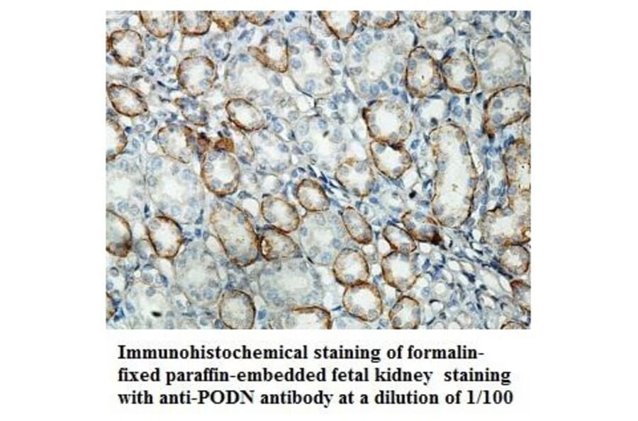 PODN Antibody from Signalway Antibody (39852) - Antibodies.com