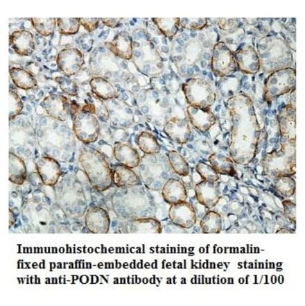 PODN Antibody from Signalway Antibody (39852) - Antibodies.com