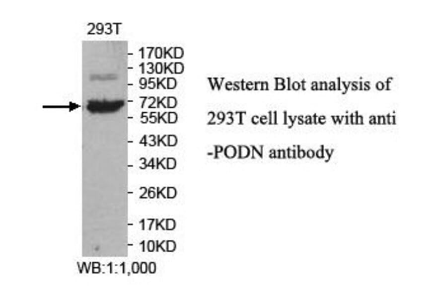 PODN Antibody from Signalway Antibody (39852) - Antibodies.com