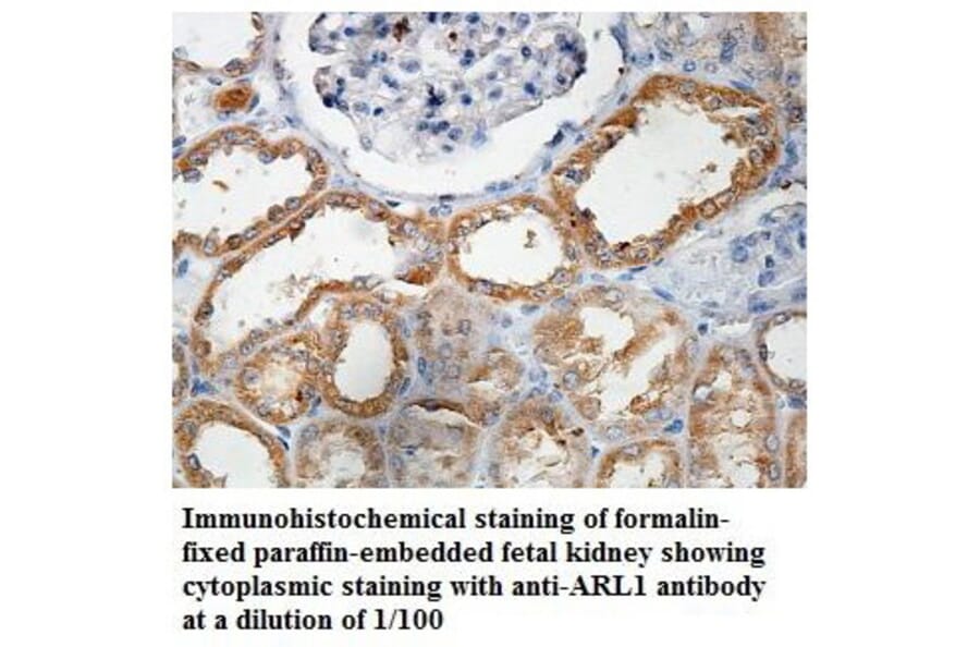 ARL1 Antibody from Signalway Antibody (39854) - Antibodies.com