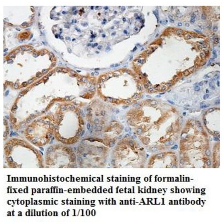 ARL1 Antibody from Signalway Antibody (39854) - Antibodies.com