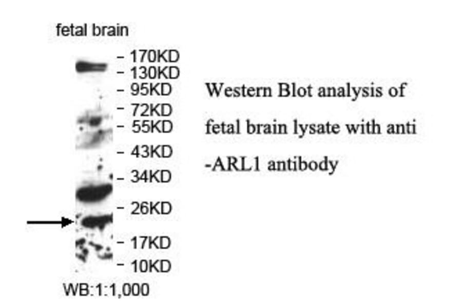 ARL1 Antibody from Signalway Antibody (39854) - Antibodies.com