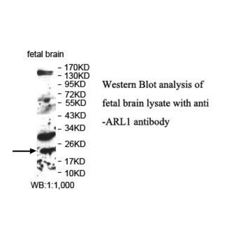 ARL1 Antibody from Signalway Antibody (39854) - Antibodies.com