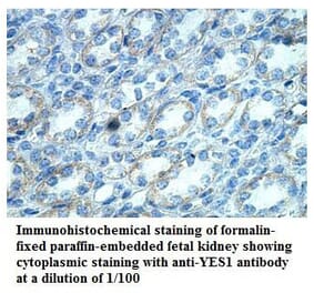 YES1 Antibody from Signalway Antibody (39868) - Antibodies.com