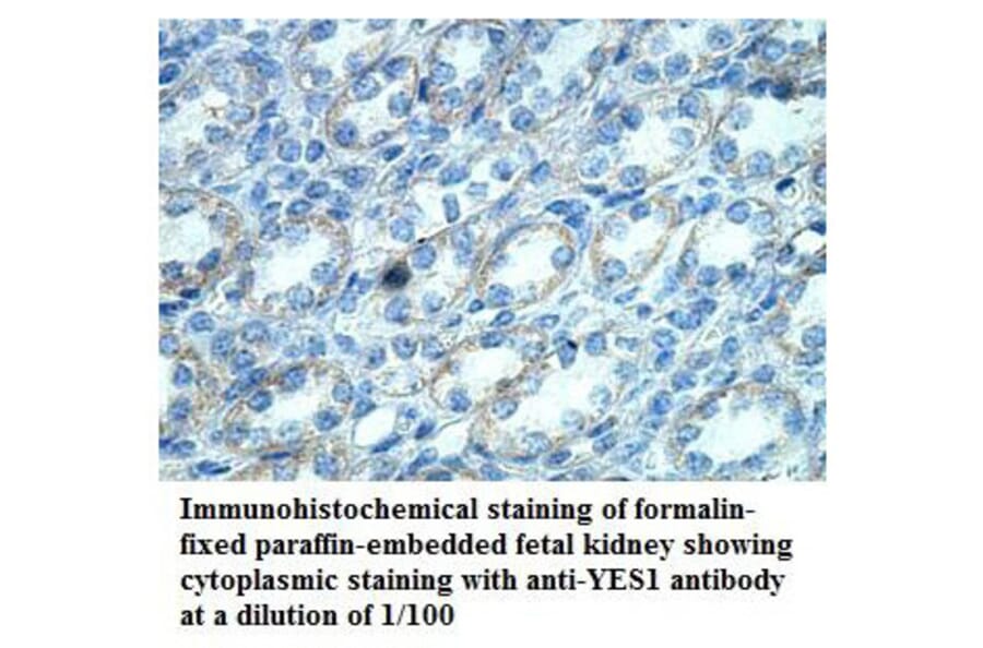 YES1 Antibody from Signalway Antibody (39868) - Antibodies.com