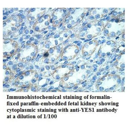 YES1 Antibody from Signalway Antibody (39868) - Antibodies.com